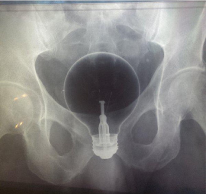 撼动灵魂深处的万解神兵。YLAN伊恋智能变频无线遥控阴道后庭多功能震动器;19 撼动灵魂深处的万解神兵。YLAN伊恋智能变频无线遥控阴道后庭多功能震动器;19