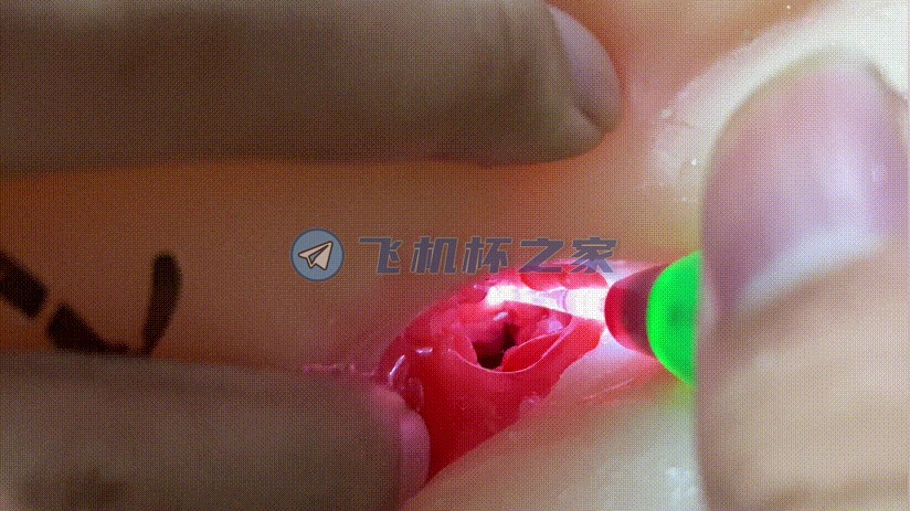 onaho小蕾来袭，突破二次元谁能顶得住？9